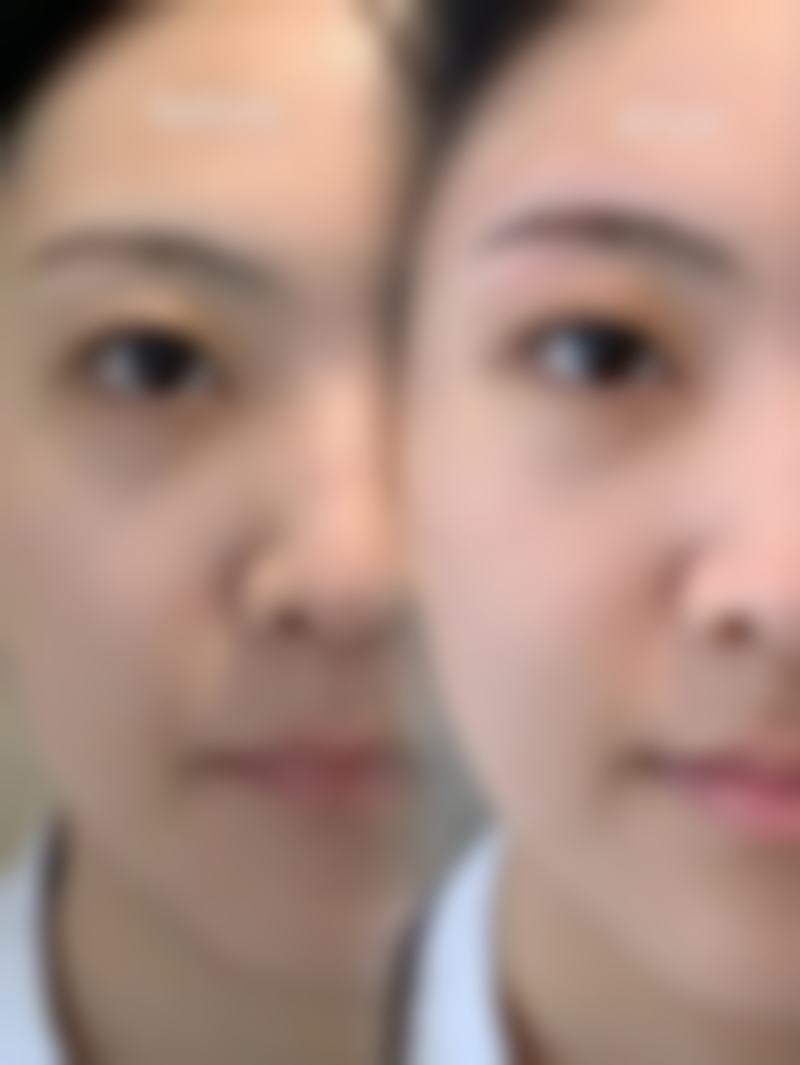 临汾雅美医疗美容门诊部价格表