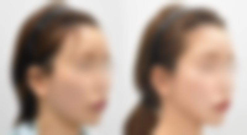 巩敏医生怎么预约挂号：便捷通道开启美丽之旅