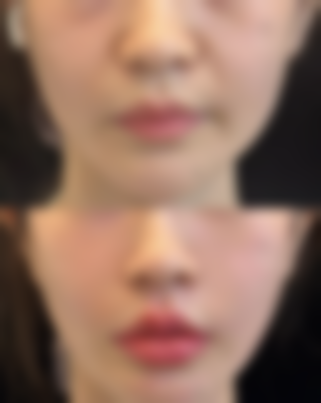 成都维莎芬医疗美容医院真实实例：见证变得更美的奇迹时刻