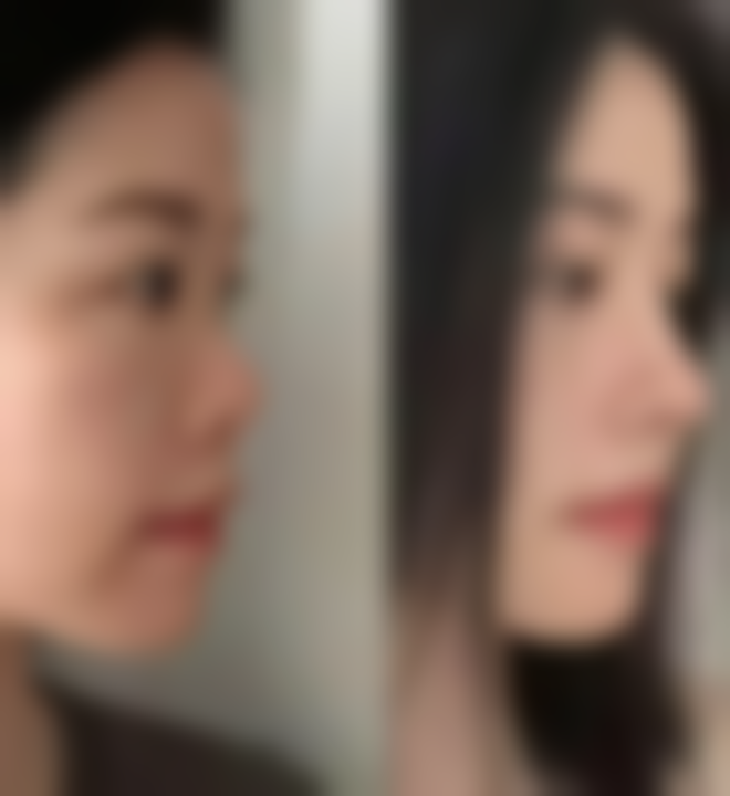 医美梁雪医生看诊优势