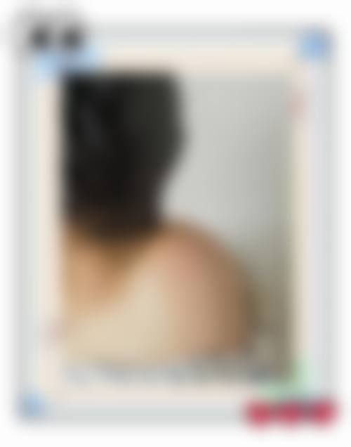 成都大眼睛整形医疗美容门诊部口碑怎么样