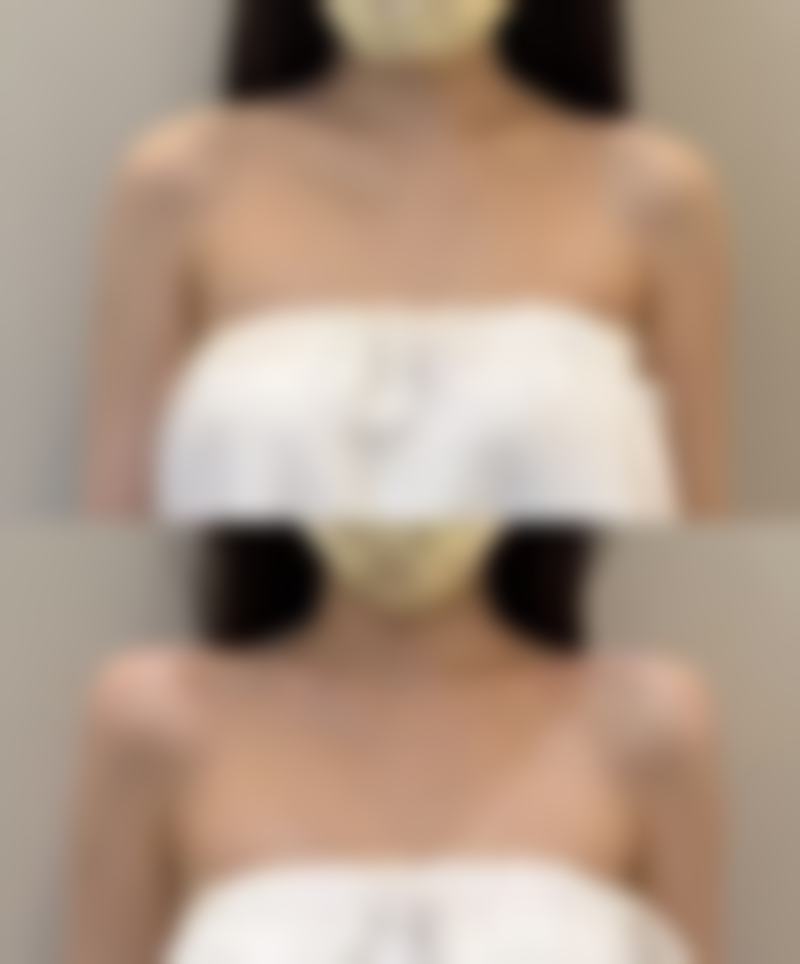 北京嘉禾医疗美容种植头发按医院级别收费值不值？