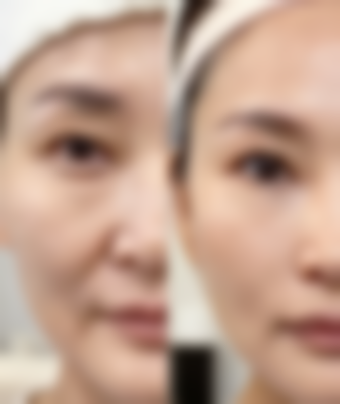 韩国 Members 整形外科医院电话号码:沟通变得更美需求的桥梁