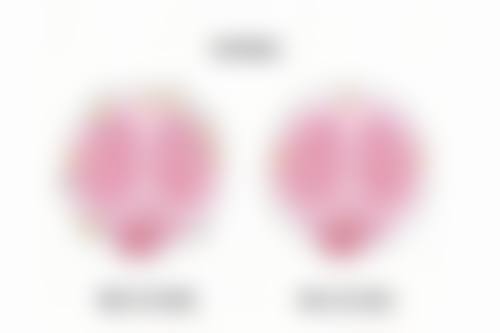 北京京韩医疗美容自体脂肪隆胸变软时间和成效有关吗