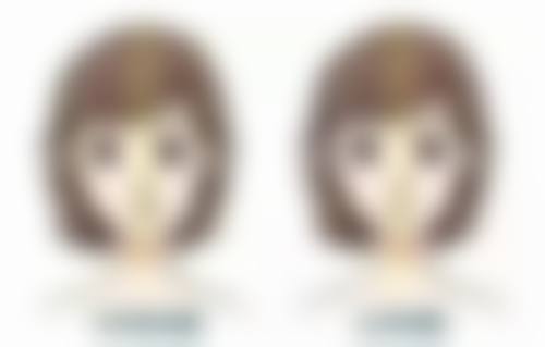 于秀英医生技术特点