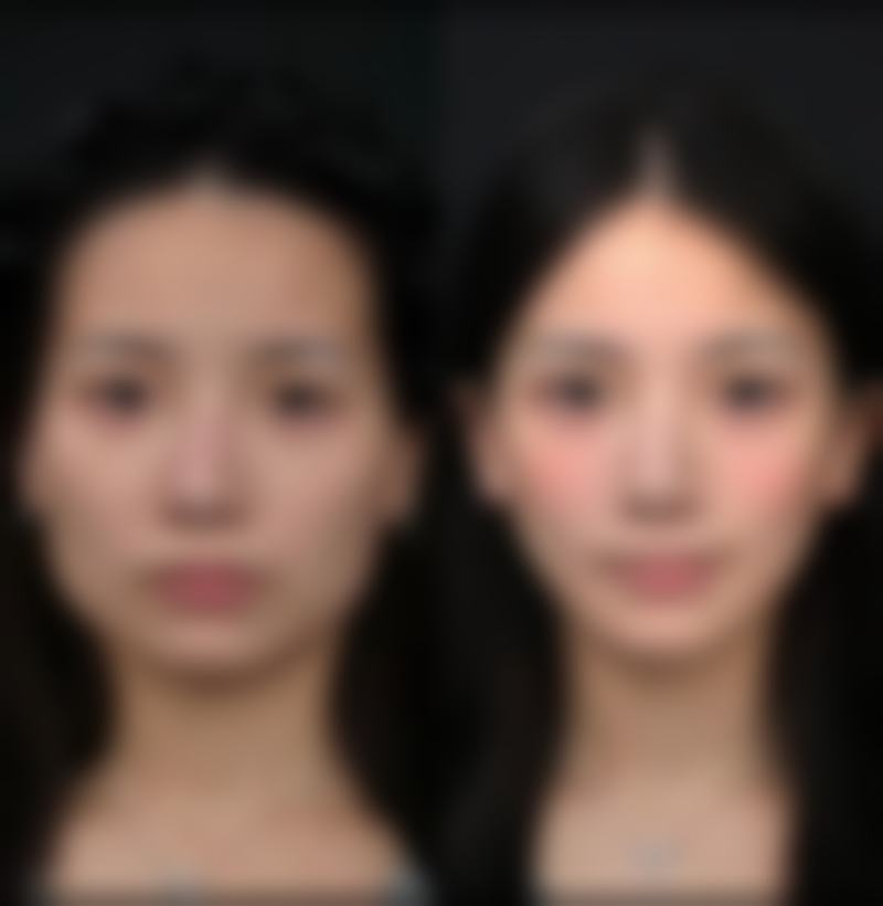 郑州倾颜医疗美容诊所擅长项目