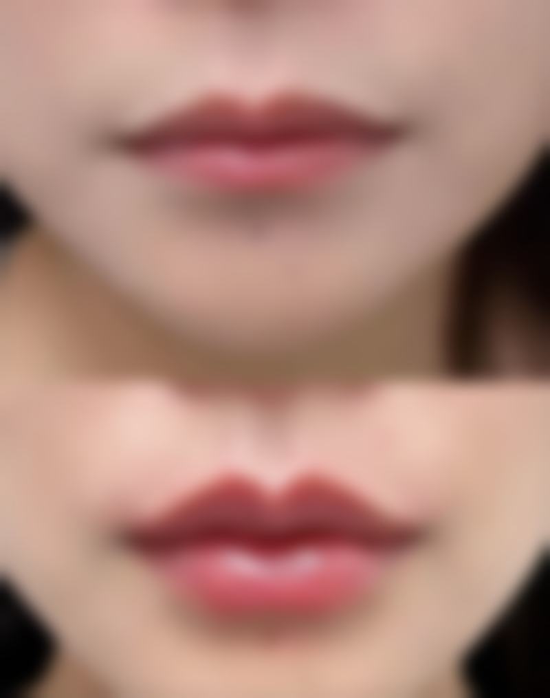 罗文娟医生坐诊医院