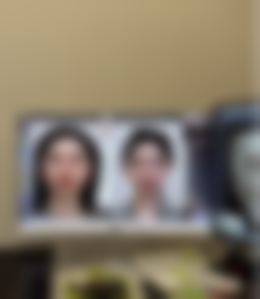 北京圣嘉新医疗美容医院自体脂肪隆胸变软慢正常吗