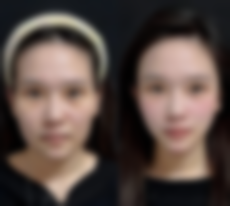 湖南长沙德尔美客整形医院仪器设备