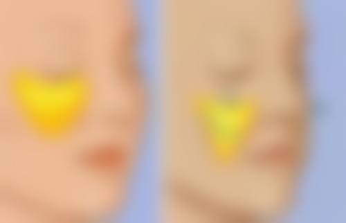 王彦坤医生技术特点