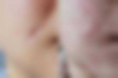 佛山瓷美颜整形医院擅长项目