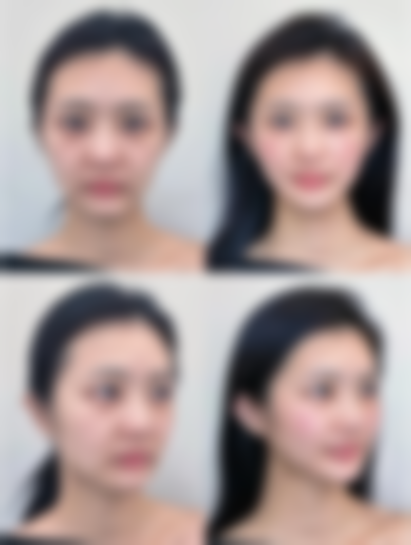 超声吸脂靠谱吗？