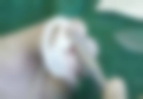 曹立铭医生的技术特点