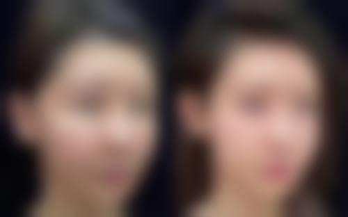 廖国善口碑评价:万千患者的共同选择