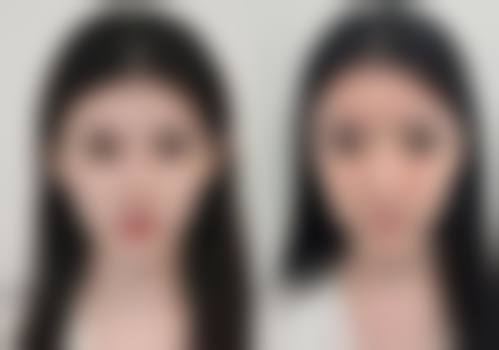 温州新生植发医疗美容门诊部口碑怎么样