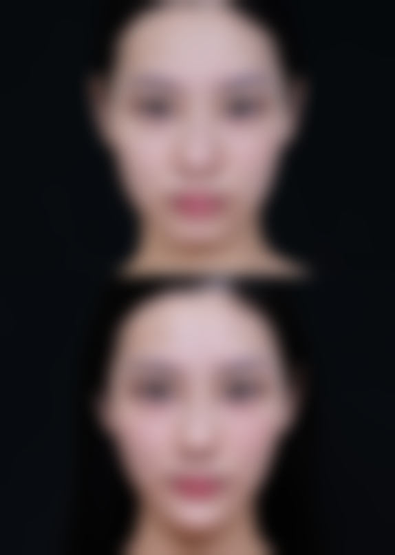 上饶璞丽斯医疗美容门诊部价格表