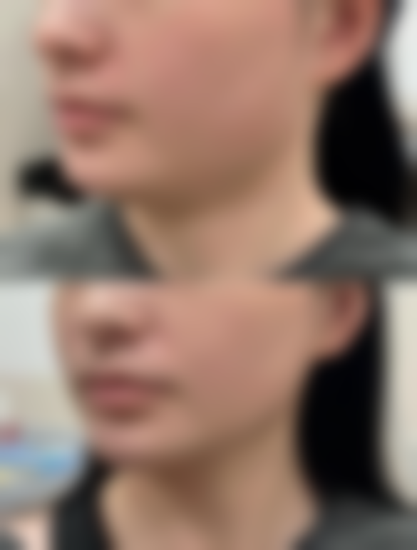 襄阳百年整形医院价格表：透明合理的消费