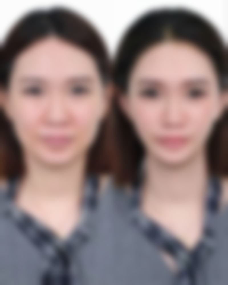 廖国善技术特点:精细、微创、美学至上