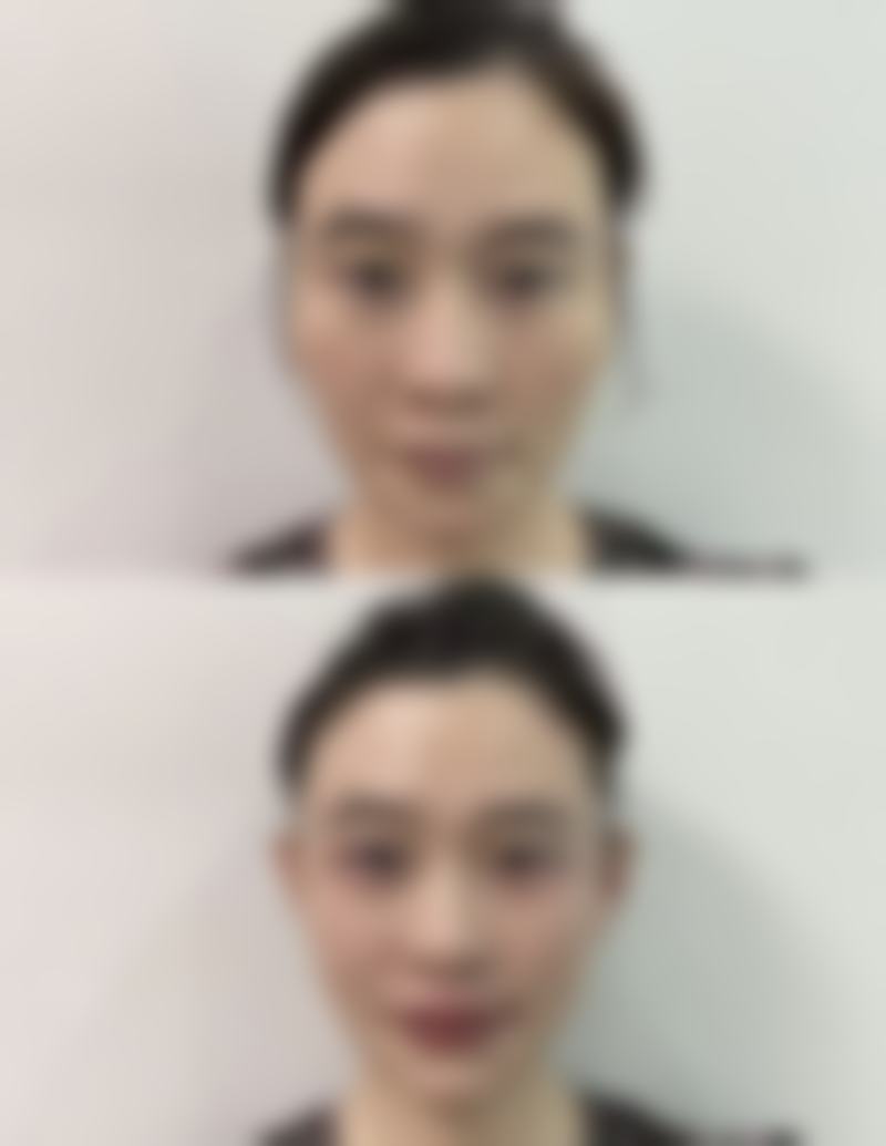 上饶璞丽斯医疗美容门诊部擅长项目