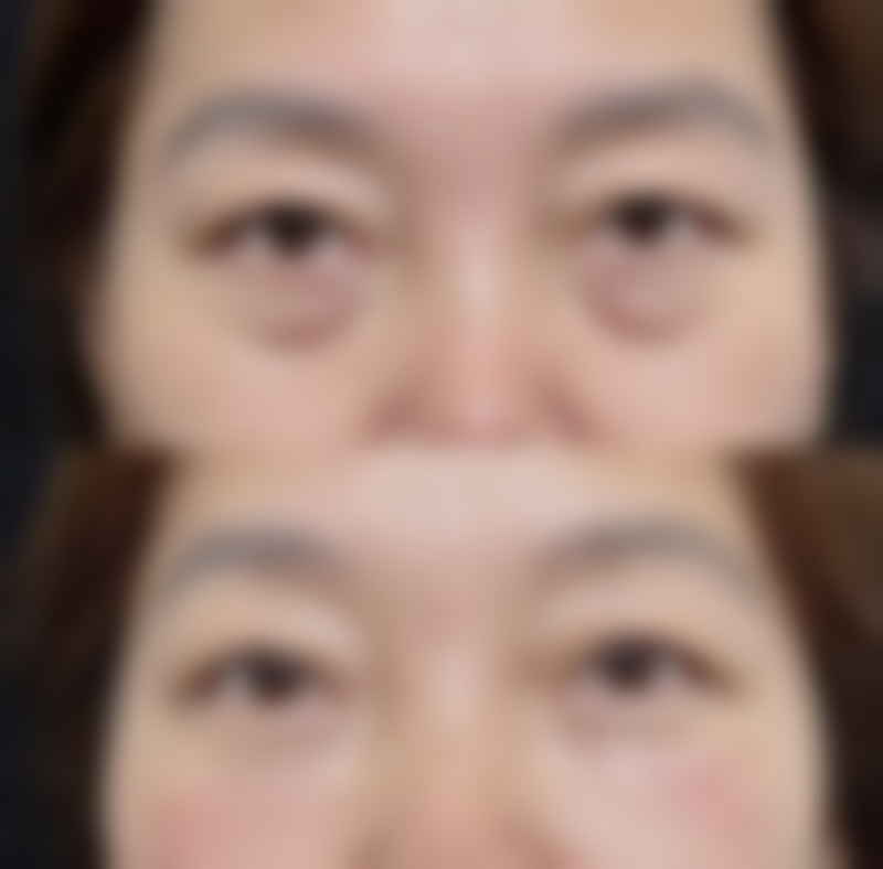 济南赵氏医疗美容诊所价格表