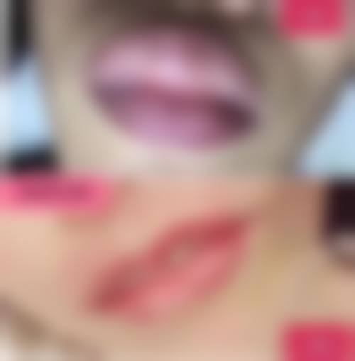 溶脂瘦脸针和其他瘦脸方法相比，副作用怎么样？