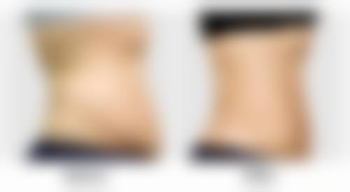 甄琳医生怎么预约挂号