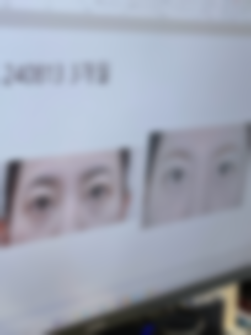 甄琳医生技术特点