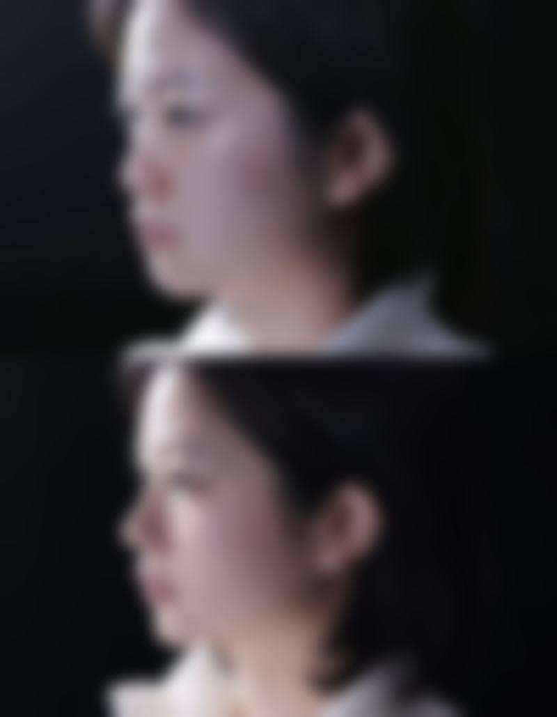 韩国江南Theme皮肤科医院真实实例