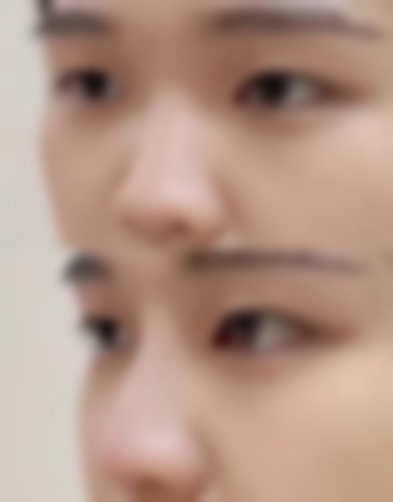 甄琳医生口碑评价