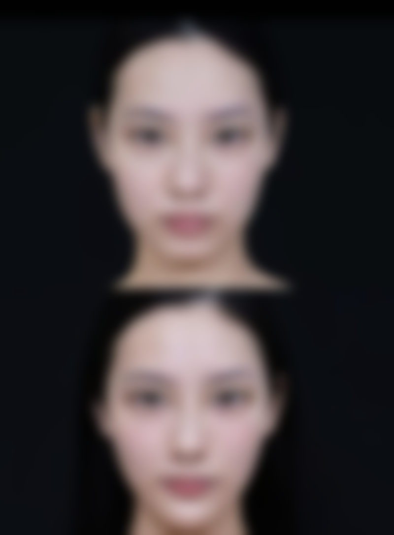 曾汉林医生坐诊医院：优质医美平台