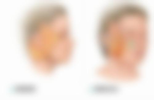 每天眼部按摩配合正确方法去眼袋靠谱吗？