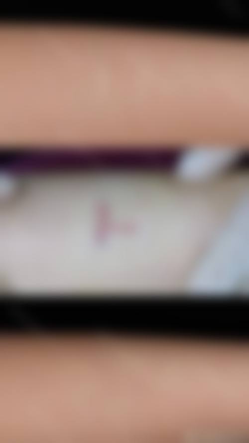 东莞东城依谋医疗美容门诊部口碑怎么样