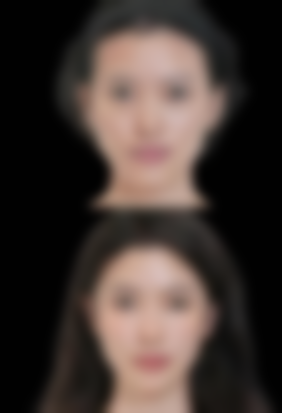 东莞东城依谋医疗美容门诊部擅长项目