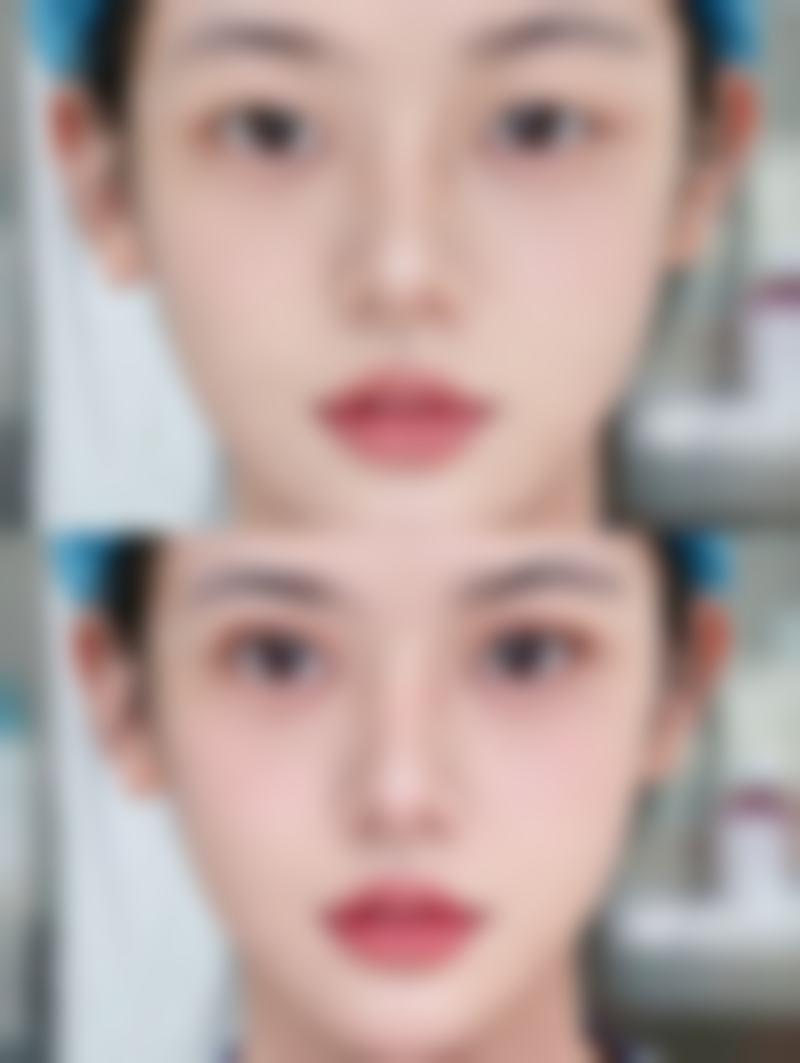 陆 军特色医学中 心（整形美容科）口碑怎么样：求美者的一致好评