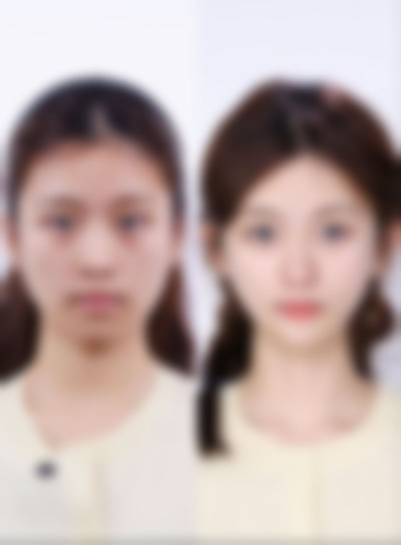 陆 军特色医学中 心（整形美容科）价格表：合理价格享受优质服务