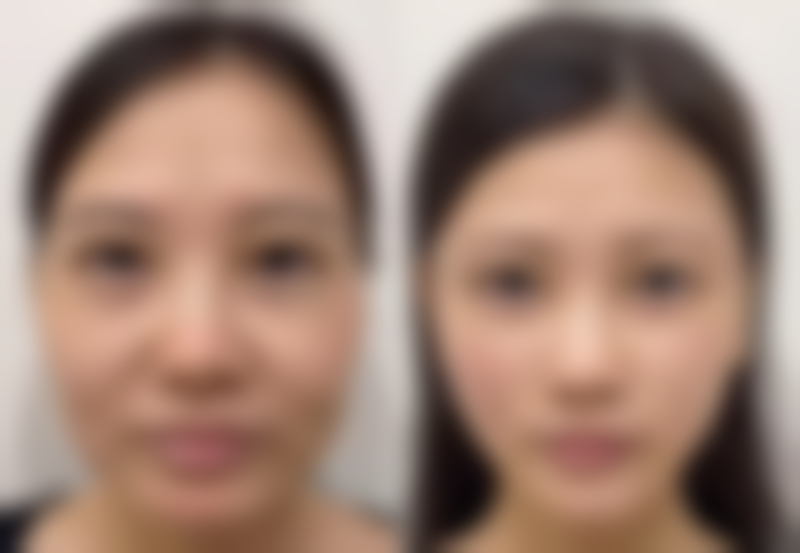 邵阳婉媄医疗美容门诊价格表