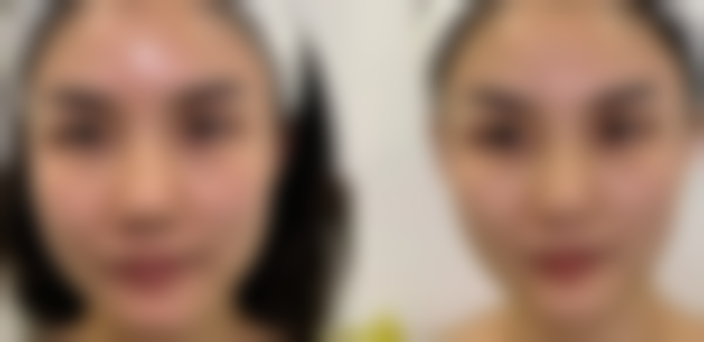 陆 军特色医学中 心（整形美容科）预约挂号方式：便捷效率高开启变得更美之旅