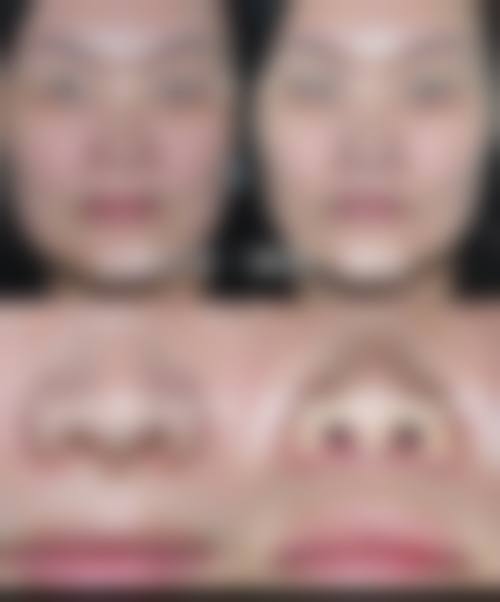 广西中 医 药大学第一附属医院（美肤激光整形科）仪器设备