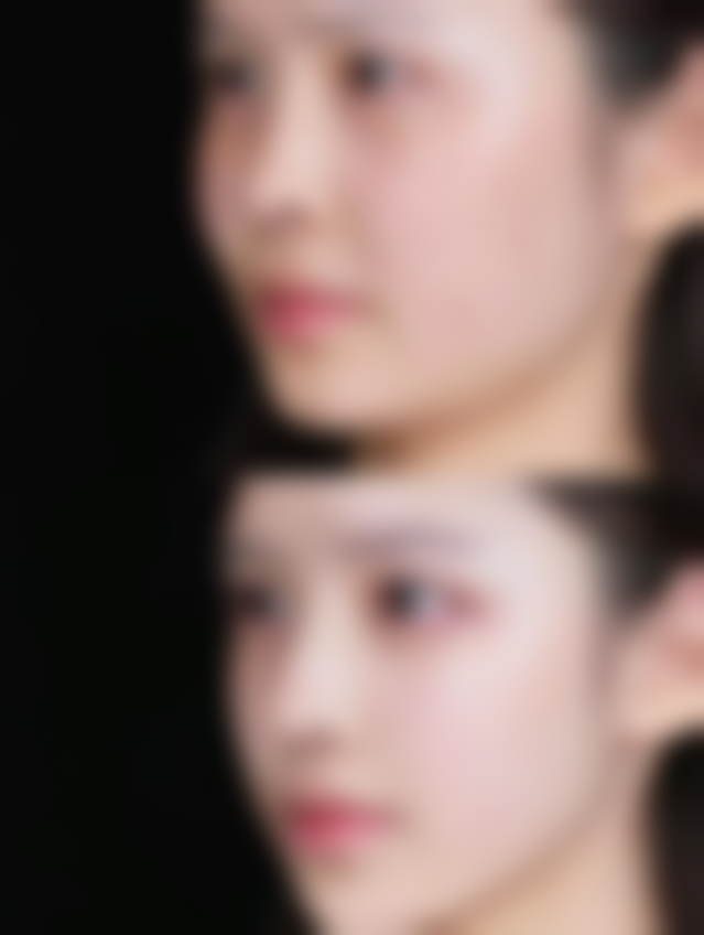 周澜华医生真实实例