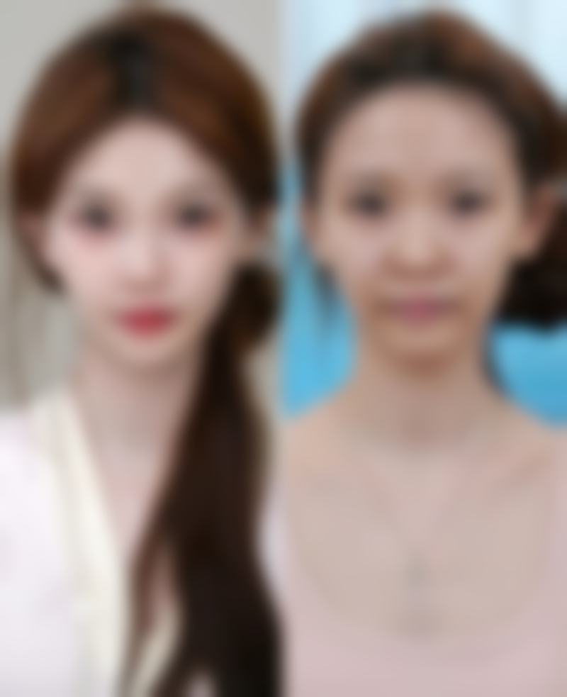 湖南省人民医院（医学美容中 心）真实实例