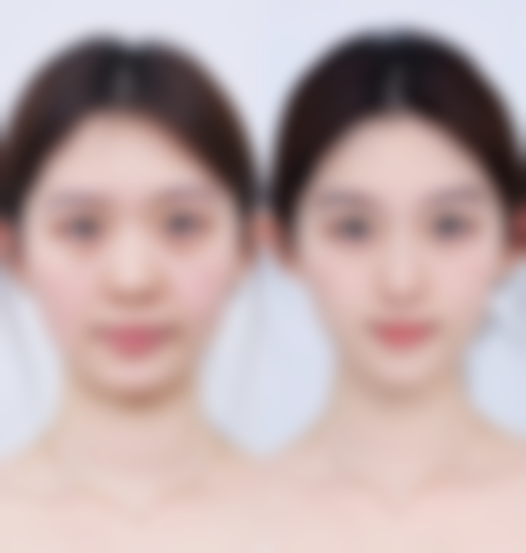 湖南省人民医院（医学美容中 心）口碑怎么样