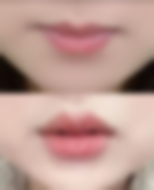 湖南省人民医院（医学美容中 心）价格表