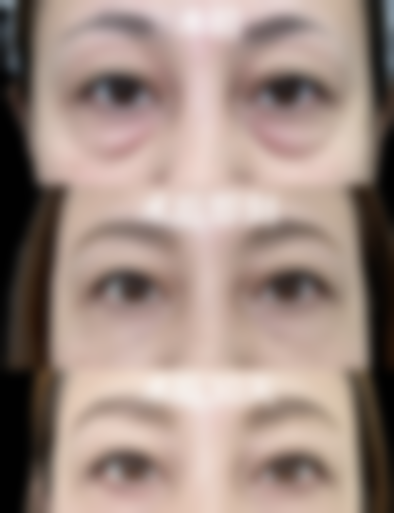 金善玉医生擅长项目