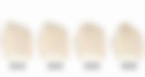 深圳米兰柏羽做双眼皮修复自然值不值