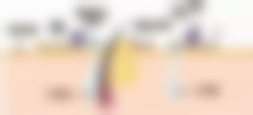 吴美容医生的技术特点