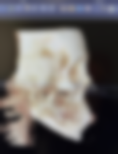 北京米兰柏羽做双眼皮修复自然适合吗