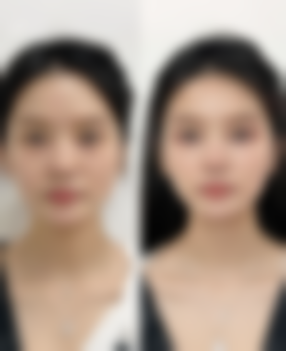 肖琴医生的技术特点