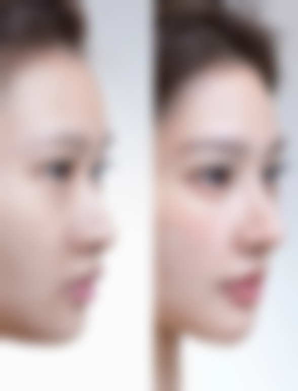 沈阳何丽蒙妮坦整形外科诊所仪器设备:精良科技助力美丽