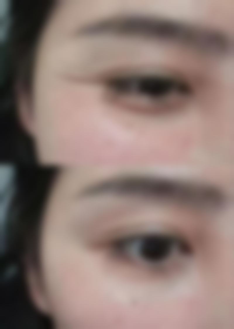 甄琳医生看诊优势：个性化关怀与专精指导