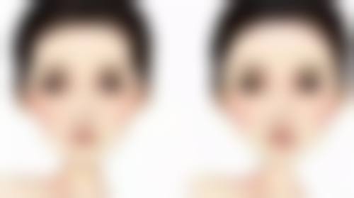 YY医美医院的按摩去眼袋适合所有人吗